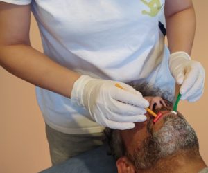 Parálisis Facial